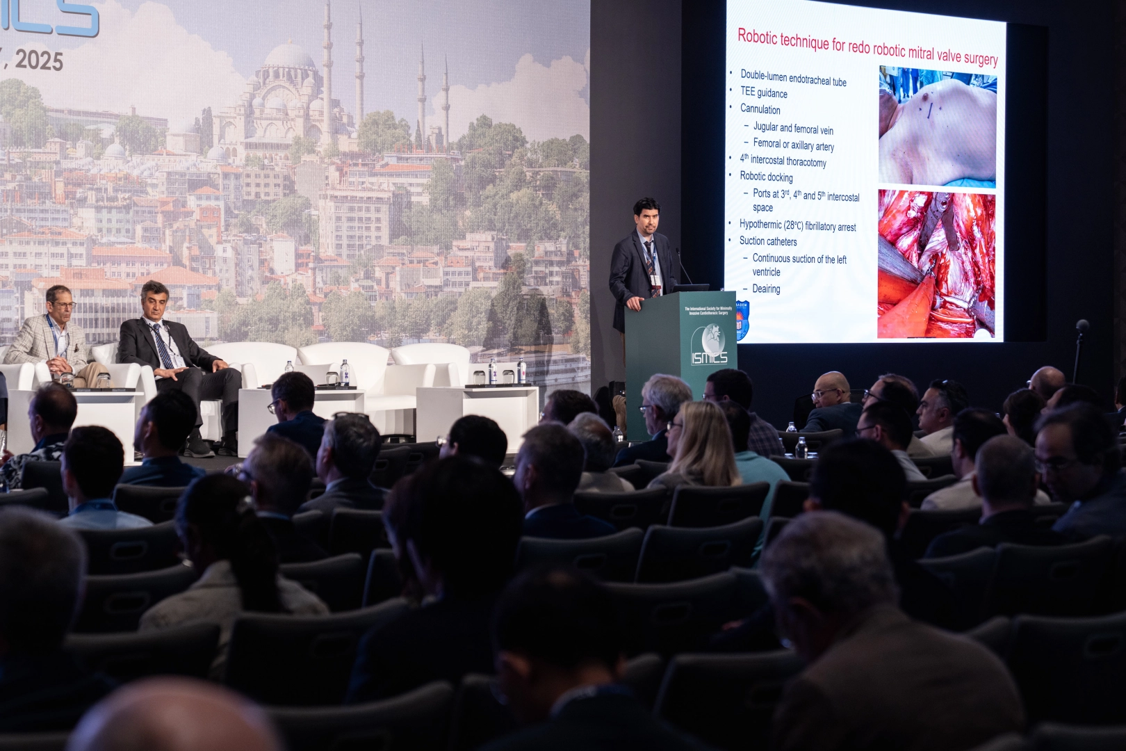 İstanbul’da kalp cerrahisinde dev buluşma 