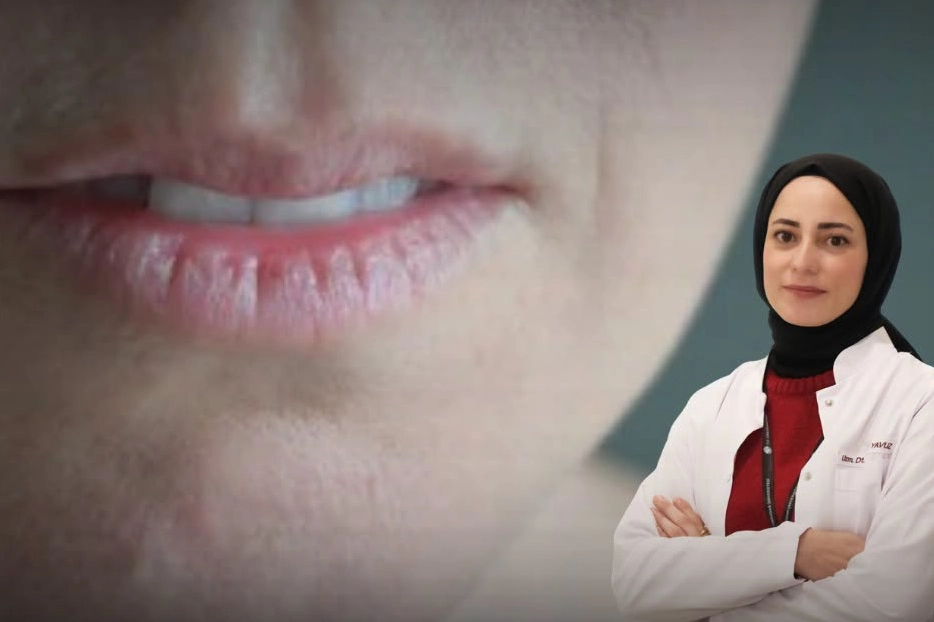Ağız kuruluğu uyarısı! Sürekli su içme ihtiyacı başka hastalıkların habercisi olabilir 
