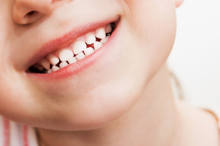 Çocuklarda diş çürüğü neden olur? Nelere dikkat edilmeli? -