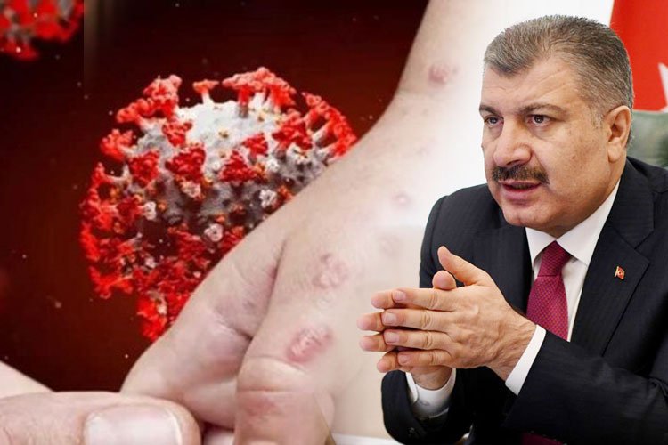 Eris varyantı Türkiye'de -