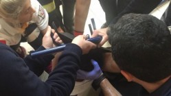 GÖRÜLMEZ KAZA ! BAŞINA DEMİR SAPLANDI