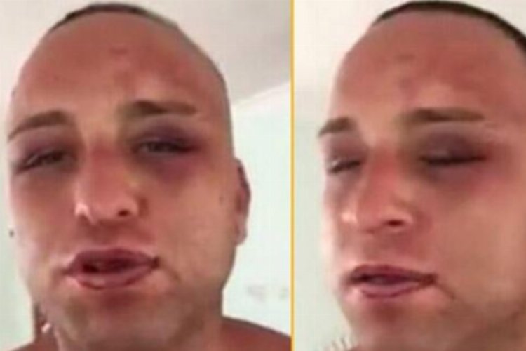 Rum mahkumlar Survivor Taner'i komalık ettiler! -